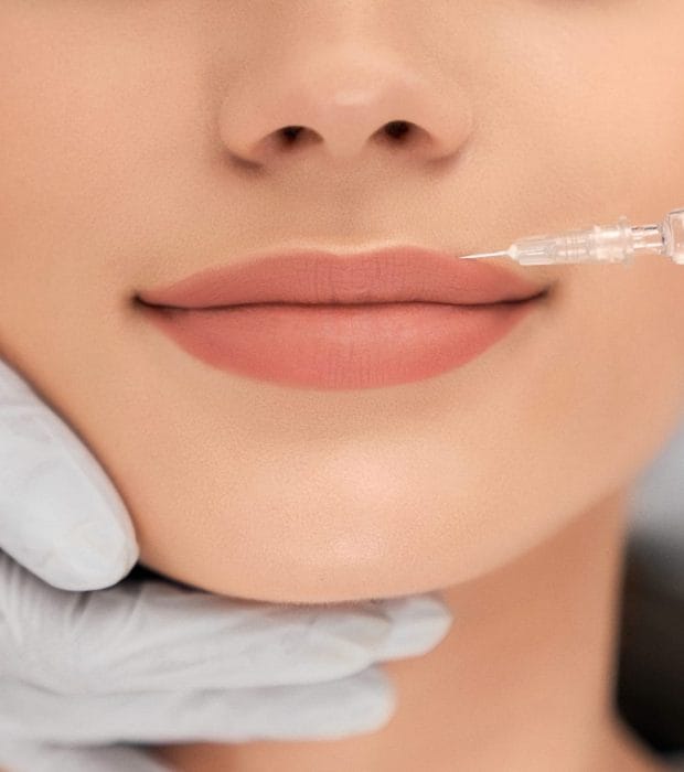 preenchimento labial mulher preenchimento labial mulher
