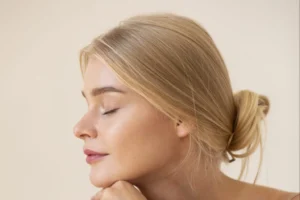 Harmonizacao facial naturalizacao post