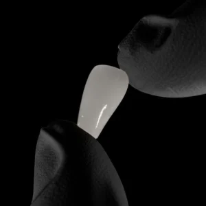 Lente porcelana unica instituto paskakulis e1754077256951